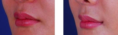 CÓMO CONSEGUIR EL LABIO PERFECTO