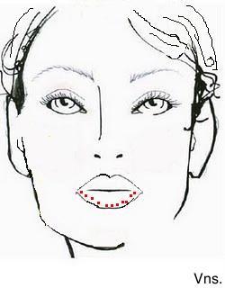 Correciones de los labios.