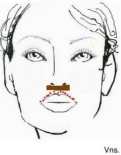 Correciones de los labios.