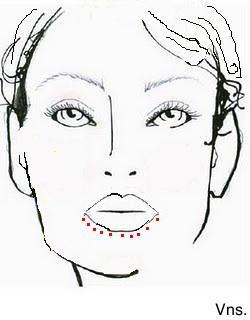 Correciones de los labios.