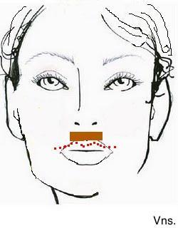 Correciones de los labios.