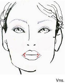 Correciones de los labios.