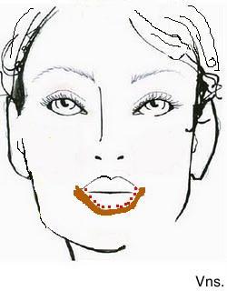 Correciones de los labios.