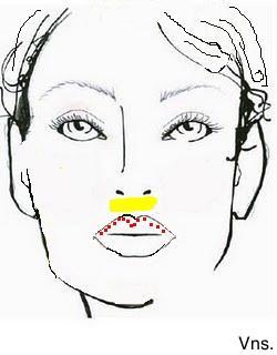 Correciones de los labios.