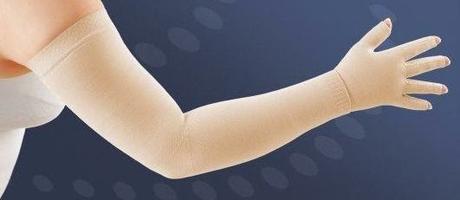 ¿Qué es el Linfedema?