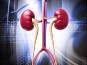 Cerca pacientes cáncer riñón tienen obesidad