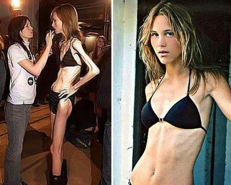 La anorexia en la moda ¿tiende a su fin?.