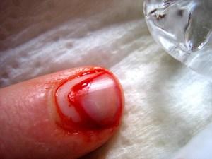 paul stumpr @ flickr.com (CC BY-SA 2.0)