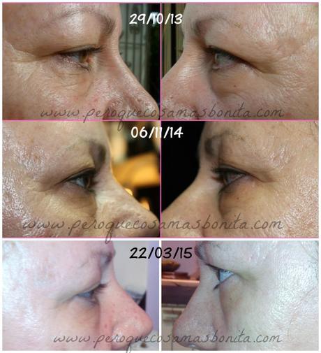 Review Galvanic Spa de NuSkin