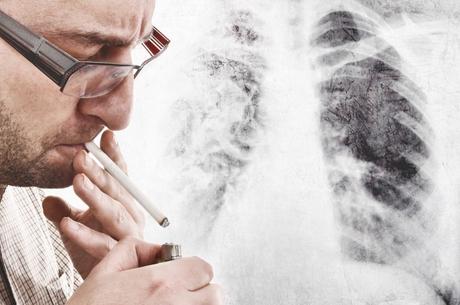 Medidas para prevenir el cáncer de pulmón