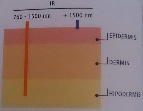 LAS RADIACIONES INFRARROJAS. TERMOTERAPIA O TERMOLIPOLISIS.
