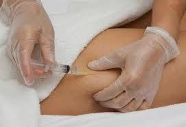 LA CELULITIS LA CELULITIS