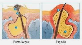PREVENIR Y ELIMINAR  LOS PUNTOS NEGROS