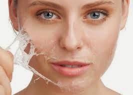 PREVENIR Y ELIMINAR LOS PUNTOS NEGROS PREVENIR Y ELIMINAR LOS PUNTOS NEGROS