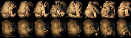 Imágenes de Ultrasonido 4D muestran cómo afecta fumar durante el embarazo al feto