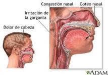 Congestion nasal: 7 Remedios caseros para tratarla