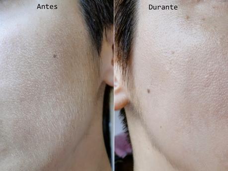 Mi experiencia con el Dermaplaning.