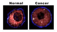 Dicloroacetato de Sodio: Cura biológica del Cancer