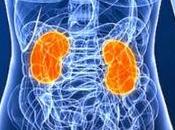 Patología Renal asociada Práctica Deportiva