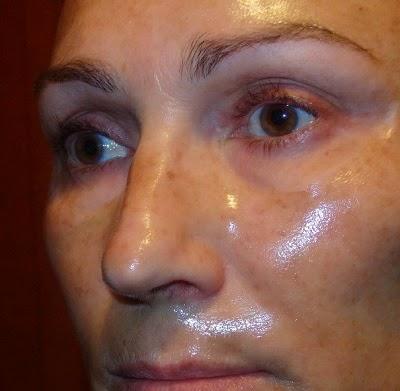 mascarilla montagne jeunesse