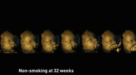 Impactantes ecografías muestran lo perjudicial que es fumar durante el embarazo.