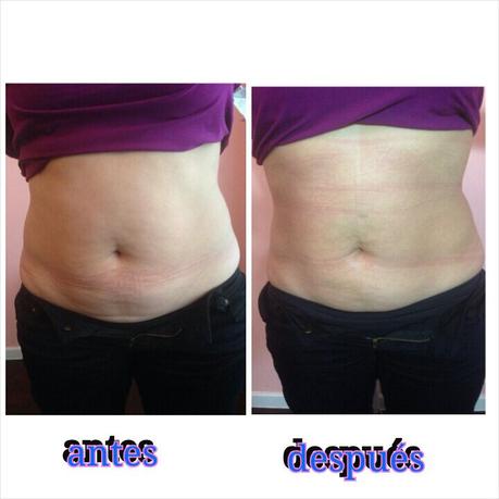 Parches de it works corporal