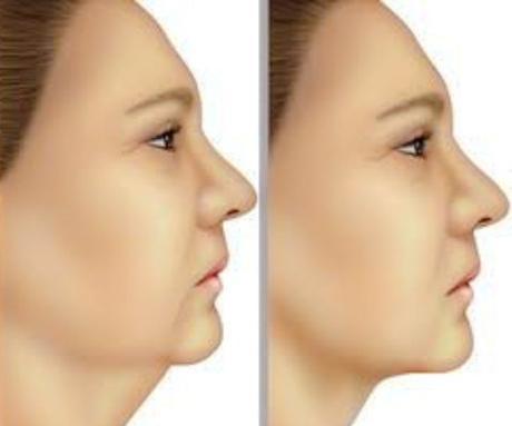 Ejercicios para la Papada como Técnica Antiedad Efectiva Ejercicios para la Papada como Técnica Antiedad Efectiva