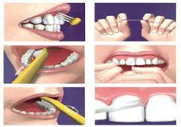 Métodos efectivos para prevenir la gingivitis Métodos efectivos para prevenir la gingivitis