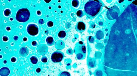 Mutaciones de tumores: la posible clave para la vacuna contra el cáncer
