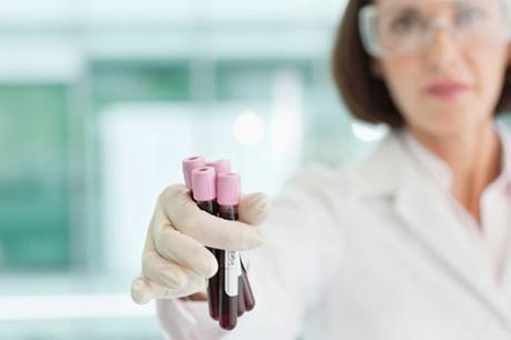 ¿Podría usted ser anémico? Los síntomas de la anemia en las mujeres anemia en las mujeres