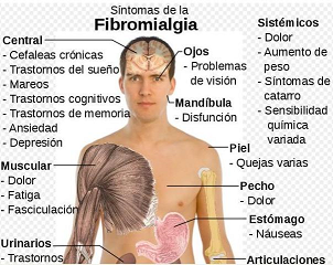 fibromialgia2 Intolerancias alimentarias e infecciones crónicas en el organismo pueden producir fibromialgia