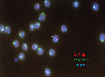 ¿Qué es el FISH en espermatozoides?