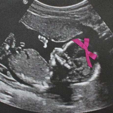 foto anunciar sexo bebé niño o niña