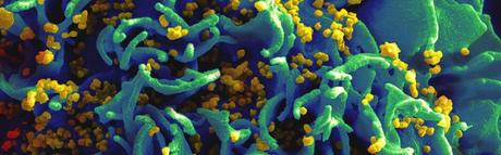 La inmunoterapia podría frenar el ataque del VIH