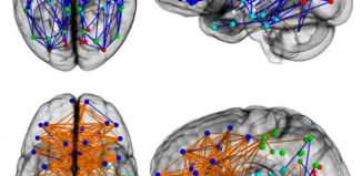 La diferencia de los cerebros según el sexo reside en el cableado neuronal (Vídeo) ¿Por qué las personas chistosas tienen más sexo?