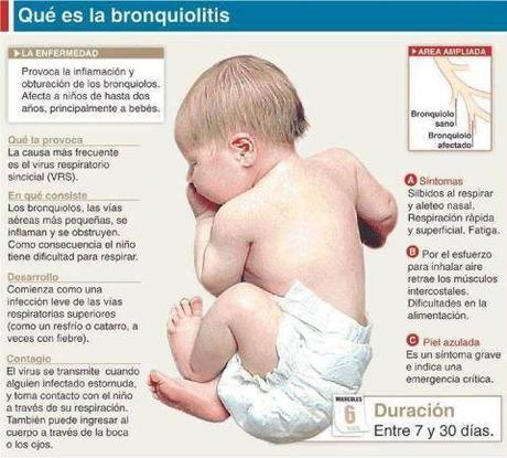 Infografía de bebé y resumen de bronquiolitis