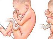 tercer trimestre embarazo