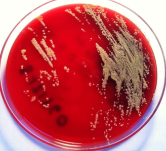 Cultivo de J. terrae en MHS a las 72 horas de incubación en aerobiosis a 35 grados./ I. Fernández Natal
