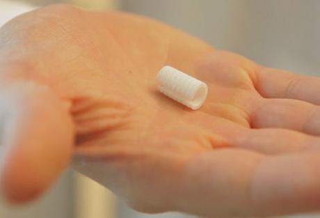 Prótesis 3D para ayudar a respirar a bebés con traqueobroncomalacia Férula para implantar en la tráquea