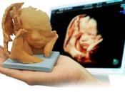 Baby3DPrint