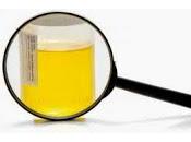 Demuestran Orina Totalmente Esteril