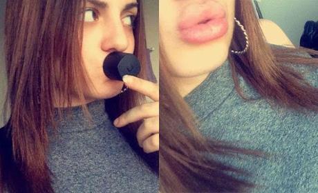 Quiero los labios de Kylie Jenner - Adolescente hormonada actual
