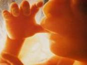 Filtro, Dice Nosotros Mismos