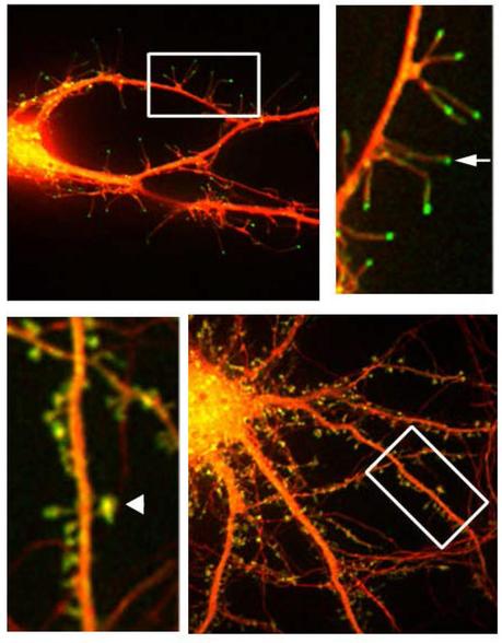 Actualidad Informática. Nueva visión de cómo el cerebro memoriza. Rafael Barzanallana