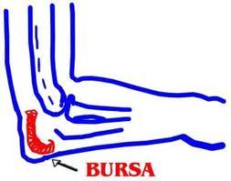 Bursitis y Pilates