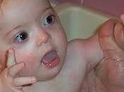 niña nació tres veces. vez: