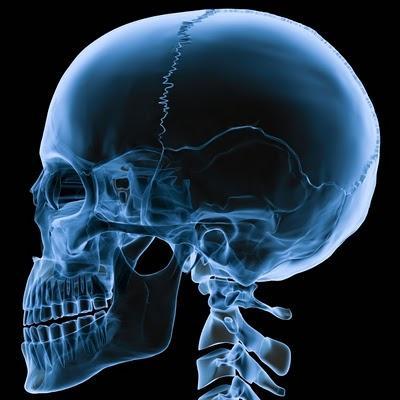 Los rayos X, una mirada al interior del cuerpo