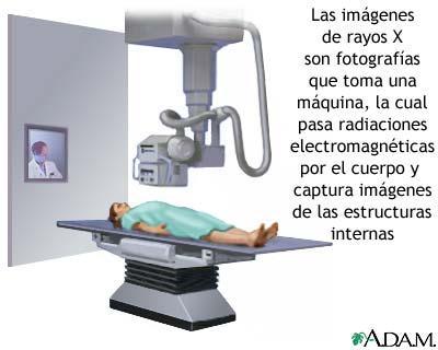 Los rayos X, una mirada al interior del cuerpo