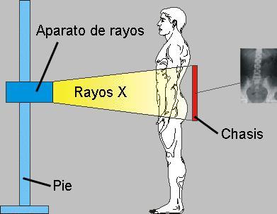 Los rayos X, una mirada al interior del cuerpo