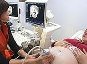 Alertan riesgos paracetamol embarazo